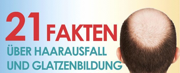 Infografik 21 Fakten über Haarausfall & Glatzenbildung