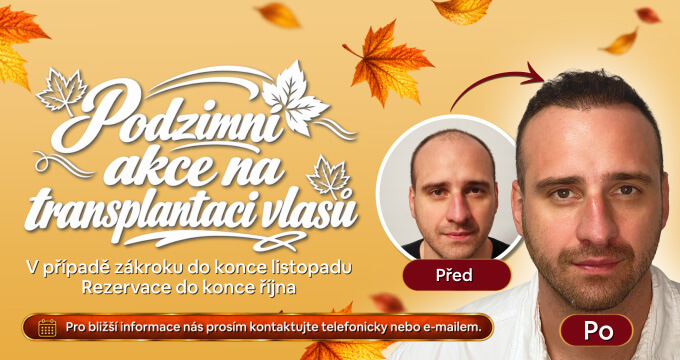 AKCE